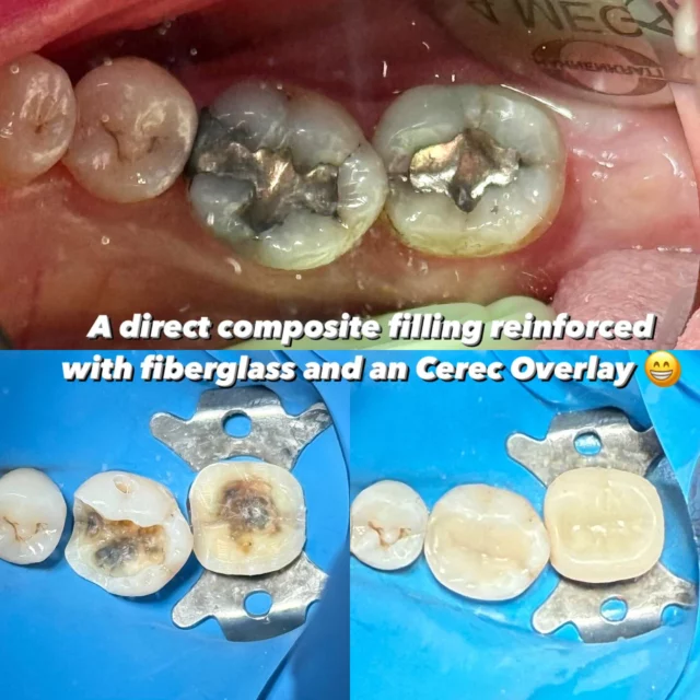 #dentist #beforeandafter #photooftheday
